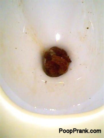 feces with blood. Blood in Poop
